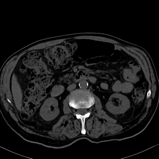 File:Normal CT intravenous cholangiogram (Radiopaedia 38199-40208 Axial IVC 53).png