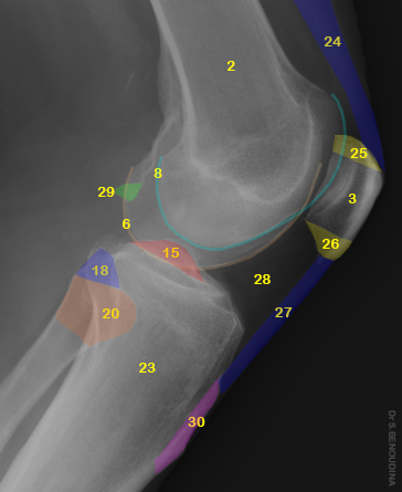 File:Normal radiographic anatomy of the knee (Radiopaedia 47923-52693 Lateral 1).jpg