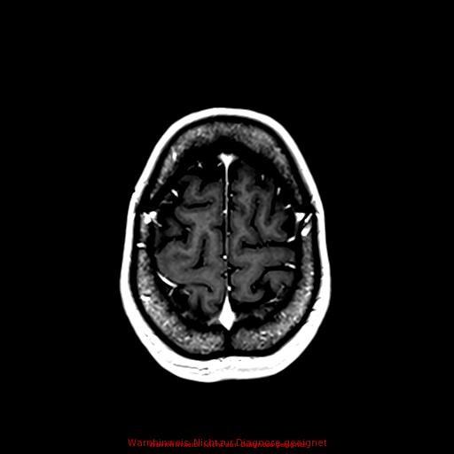 Normal adult brain MRI (non-enhanced and contrast-enhanced) (Radiopaedia 75262-86379 Axial T1 C+ 157).jpg