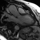 File:Cardiac MRI- standard imaging planes (Radiopaedia 14225-14090 C 25).jpg