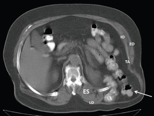 File:PMC3959346 AnnGastroenterol-25-64-g001.png