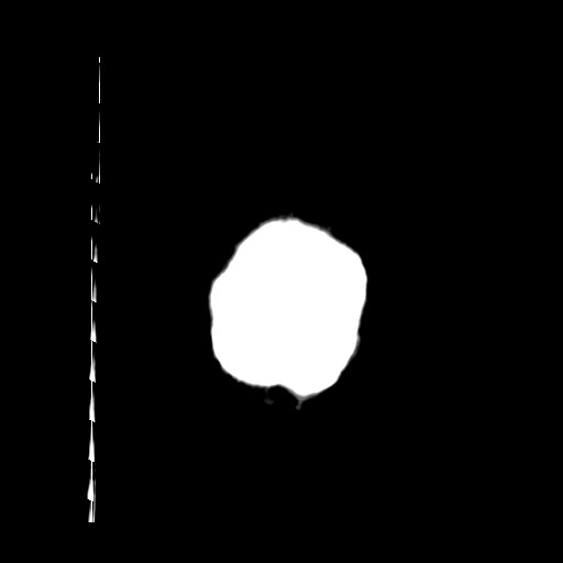 Carotid near-occlusion (Radiopaedia 85304-100887 Coronal non-contrast 73).jpg
