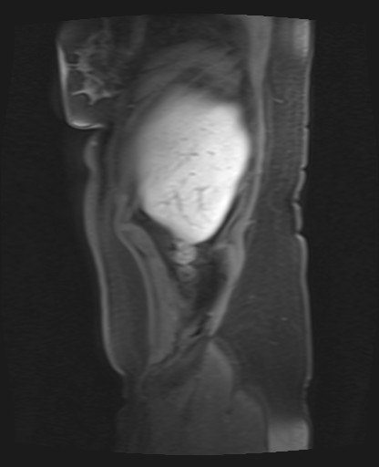 File:Normal hepatobiliary phase liver MRI (Radiopaedia 58968-66230 C 8).jpg