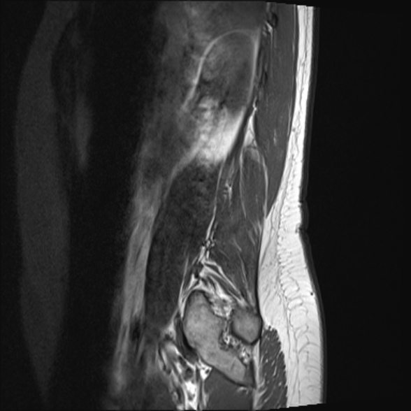 File:Normal lumbar spine MRI- 3 T (Radiopaedia 53280-59250 Sagittal T1 1).jpg