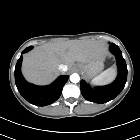 File:Normal multiphase CT liver (Radiopaedia 38026-39996 B 11).jpg