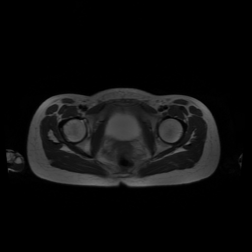 File:Normal MRI abdomen in pregnancy (Radiopaedia 88001-104541 Axial T2 68).jpg