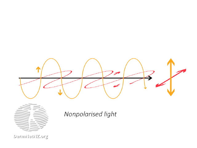 File:Nonpolarised light (DermNet NZ nonpolarised-light).jpg
