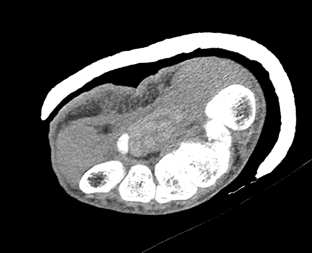 Normal wrist CT (Radiopaedia 41425-44297 Axial non-contrast 22).png