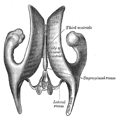 File:Diagram of ventricular system (Radiopaedia 36259).jpg