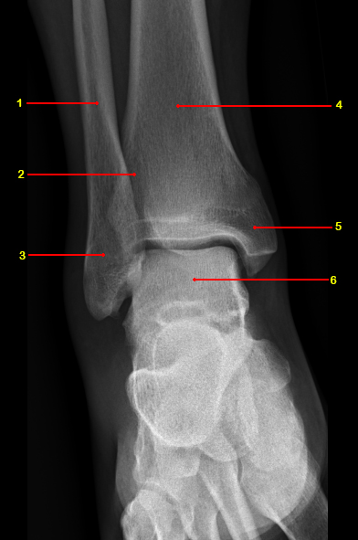 File:Normal radiographic anatomy of the ankle (Radiopaedia 42814-45987 A 1).jpg