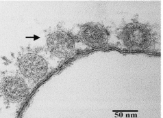 Thin-section electron micrograph of severe acute respiratory syndrome-associated coronavirus