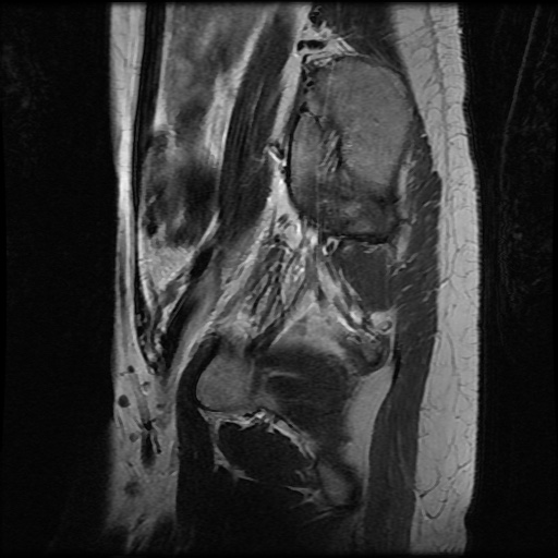 File:Normal female pelvis MRI (retroverted uterus) (Radiopaedia 61832-69933 Sagittal T2 28).jpg