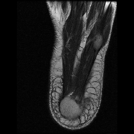 File:Anterior calcaneal process fracture (Radiopaedia 74654-85611 Axial T2 29).jpg