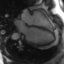 File:Cardiac MRI- standard imaging planes (Radiopaedia 14225-14090 B 1).jpg