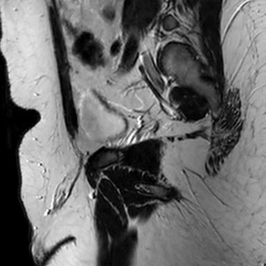 File:Normal prostate (MRI) (Radiopaedia 29986-30535 Sagittal T2 19).jpg