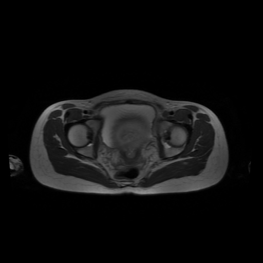 File:Normal MRI abdomen in pregnancy (Radiopaedia 88001-104541 Axial T2 65).jpg