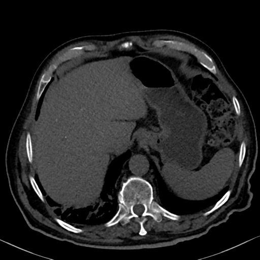 File:Normal CT intravenous cholangiogram (Radiopaedia 38199-40208 Axial IVC 19).png