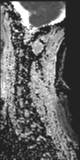 File:Normal MRI cervical spine (infection protocol) (Radiopaedia 53916-60039 Sagittal 11).png