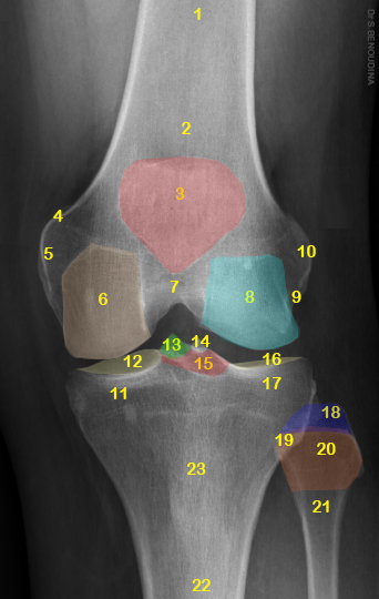 File:Normal radiographic anatomy of the knee (Radiopaedia 47923-52693 Frontal 1).jpg