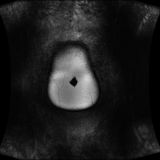Normal MRI abdomen in pregnancy (Radiopaedia 88001-104541 N 13).jpg