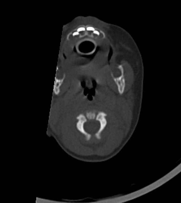 Normal brain CT - 2-month-old (Radiopaedia 53369-59350 Axial bone window 61).jpg