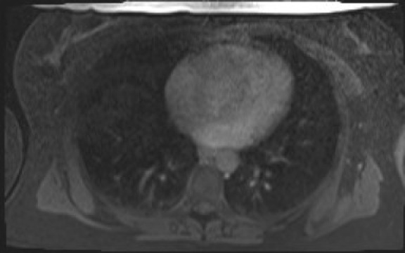 File:Normal hepatobiliary phase liver MRI (Radiopaedia 58968-66230 A 4).jpg