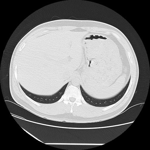 Azygos fissure (Radiopaedia 88181-104784 Axial lung window 52).jpg