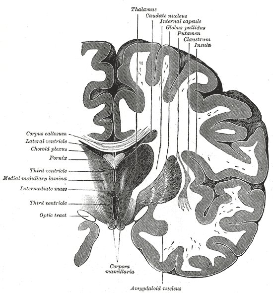 File:Coronal brain through 3rd ventricle (Radiopaedia 36260).jpg