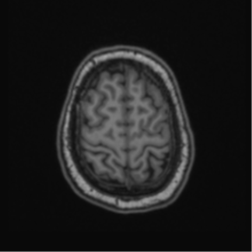 Cerebellar hemangioblastomas and pituitary adenoma (Radiopaedia 85490-101176 Axial T1 62).png