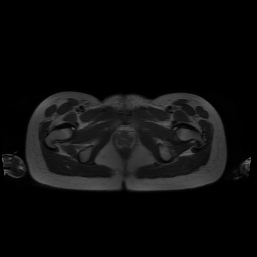 File:Normal MRI abdomen in pregnancy (Radiopaedia 88001-104541 Axial T2 72).jpg