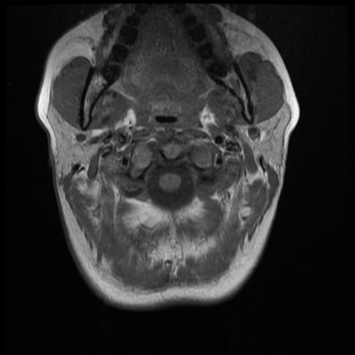 File:Normal cervical and thoracic spine MRI (Radiopaedia 35630-37156 Axial T1 30).png