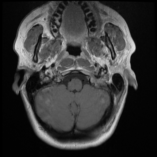 File:Normal cervical and thoracic spine MRI (Radiopaedia 35630-37156 Axial T1 C+ 34).png