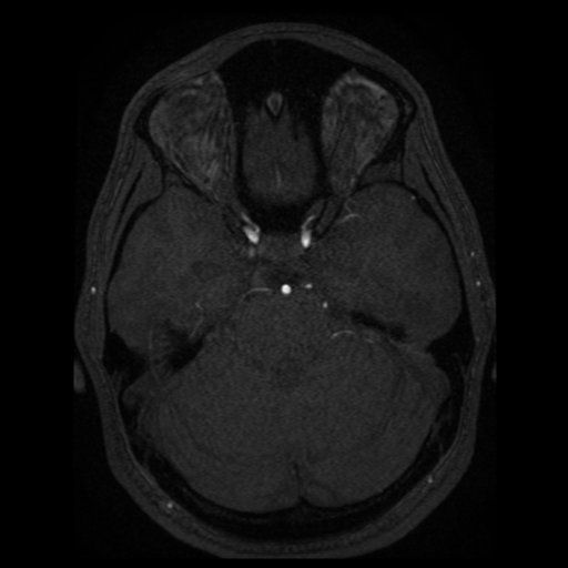 Normal brain MRA (Radiopaedia 41046-43793 Axial MRA 68).png