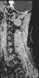 File:Normal MRI cervical spine (infection protocol) (Radiopaedia 53916-60039 Sagittal 1).png