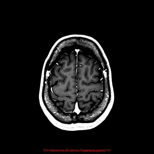 Normal adult brain MRI (non-enhanced and contrast-enhanced) (Radiopaedia 75262-86379 Axial T1 C+ 153).jpg