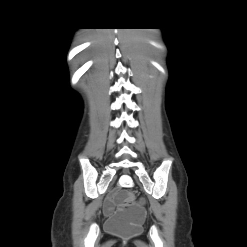 File:Colocolic fistula - Crohn disease (Radiopaedia 57063-63955 B 38).jpg