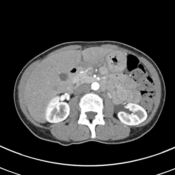 File:Normal multiphase CT liver (Radiopaedia 38026-39996 B 35).jpg