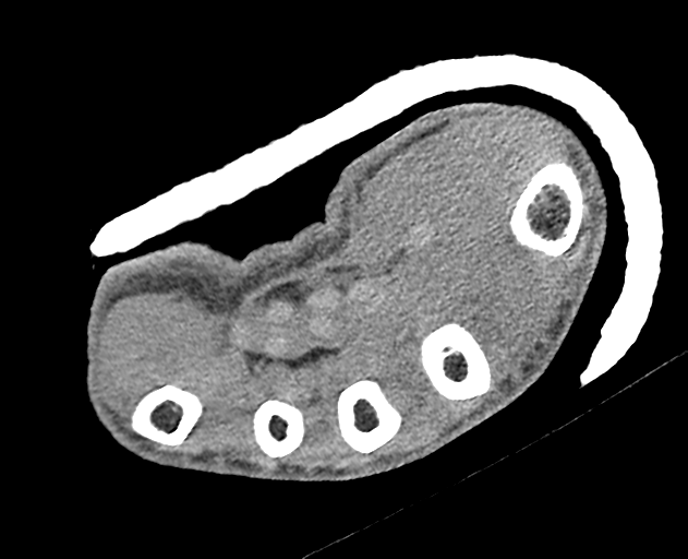 Normal wrist CT (Radiopaedia 41425-44297 Axial non-contrast 17).png