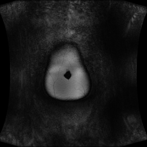 Normal MRI abdomen in pregnancy (Radiopaedia 88001-104541 N 12).jpg