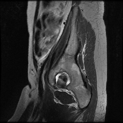 File:Normal female pelvis MRI (retroverted uterus) (Radiopaedia 61832-69933 Sagittal T2 3).jpg
