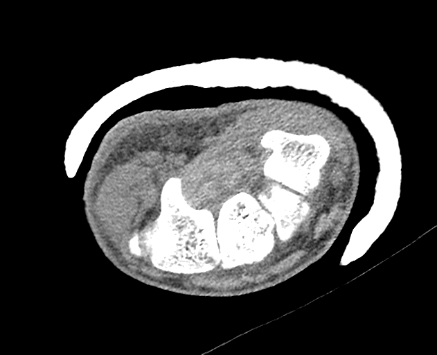 Normal wrist CT (Radiopaedia 41425-44297 Axial non-contrast 26).png