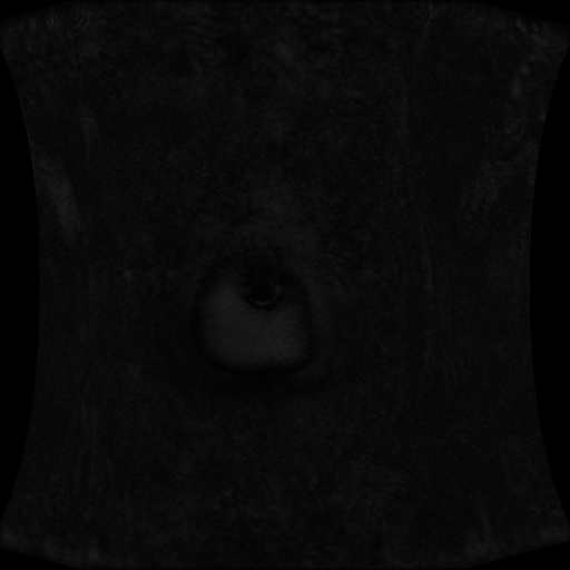Normal MRI abdomen in pregnancy (Radiopaedia 88001-104541 N 7).jpg