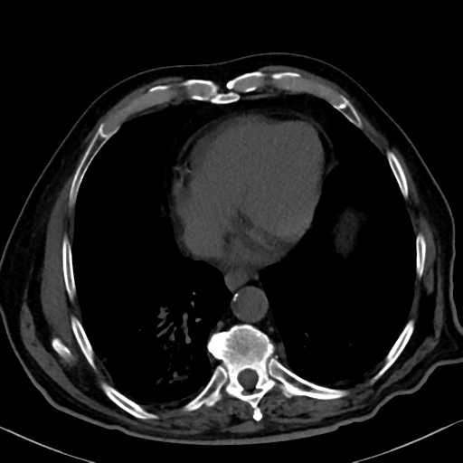 File:Normal CT intravenous cholangiogram (Radiopaedia 38199-40208 Axial IVC 8).png