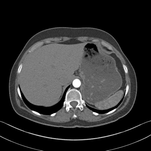 File:Normal CT renal artery angiogram (Radiopaedia 38727-40889 A 18).png