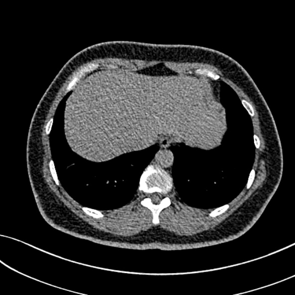 Normal CT chest- adult female (Radiopaedia 52522-58428 Axial non-contrast 106).jpg