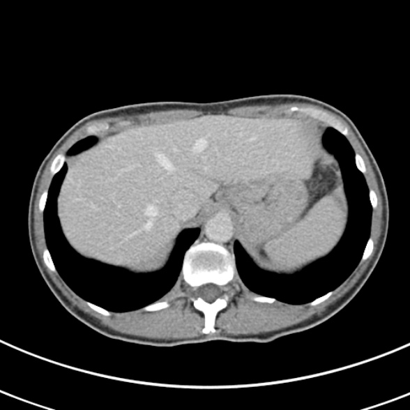 File:Normal multiphase CT liver (Radiopaedia 38026-39996 C 11).jpg