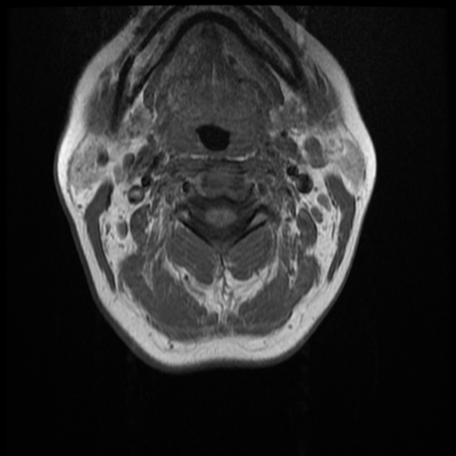 File:Normal cervical and thoracic spine MRI (Radiopaedia 35630-37156 Axial T1 26).png