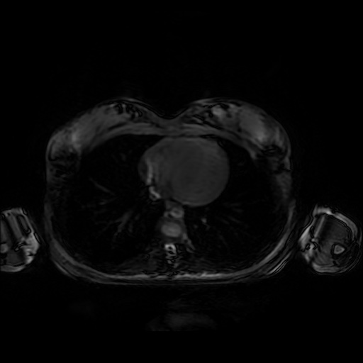 File:Normal MRI abdomen in pregnancy (Radiopaedia 88001-104541 D 2).jpg