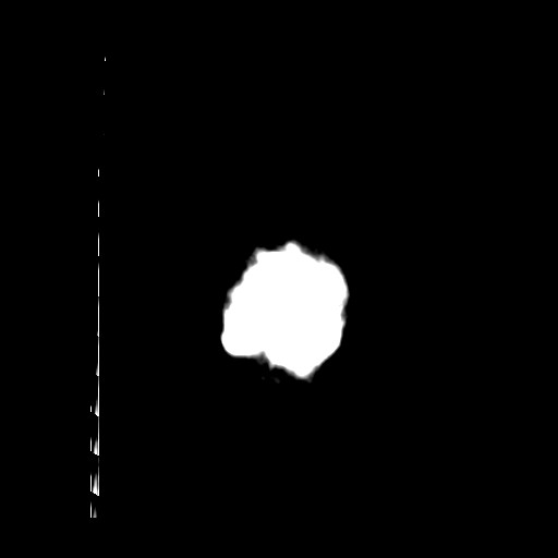 Carotid near-occlusion (Radiopaedia 85304-100887 Coronal non-contrast 74).jpg