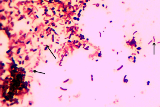 Campylobacter species arrows stained by 1% carbol fuchsin